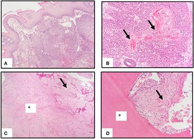 Genomic landscape and gene expression profiles of feline oral squamous cell carcinoma